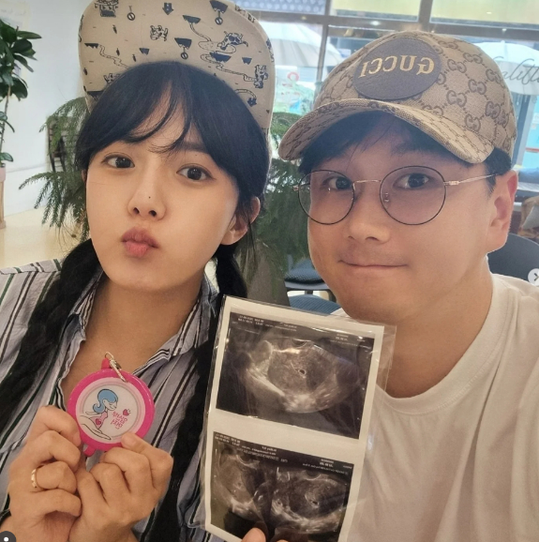 강은비, 결혼 3개월 만에 임신 소식 알려